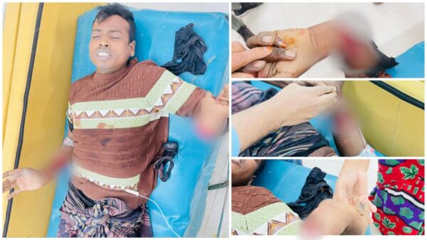 খুলনায় বাড়ি থেকে ডেকে নিয়ে যুবকের দু’হাত কেটে দিলো দুর্বৃত্তরা