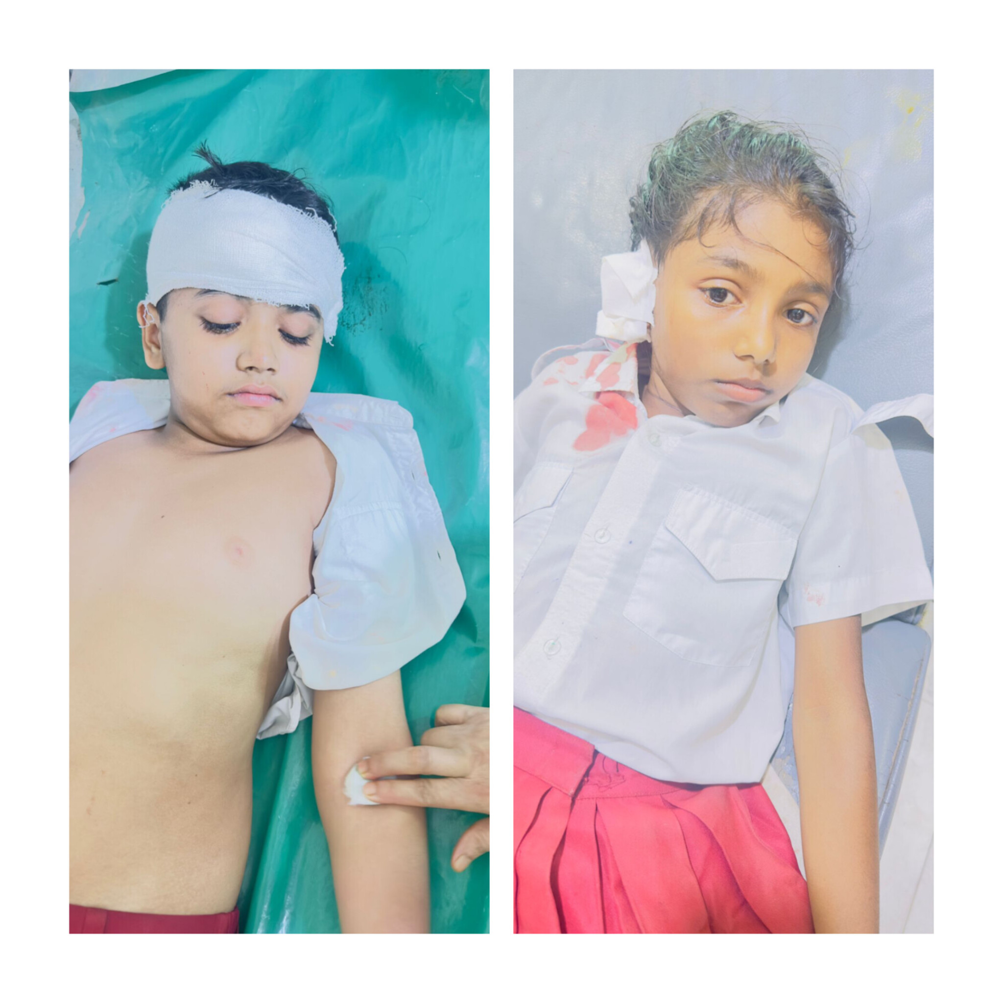 নাজিরপুরে ক্লাস চলার সময় ভেঙে পড়ল পাখা, দুই শিক্ষার্থী আহত